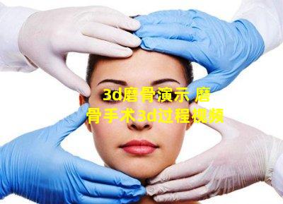 3d磨骨演示 磨骨手术3d过程视频
